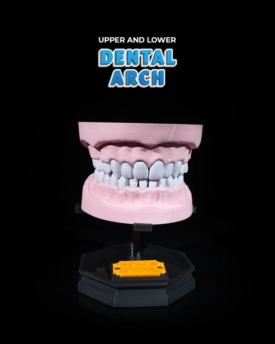 Upper and Lower Dental Arch